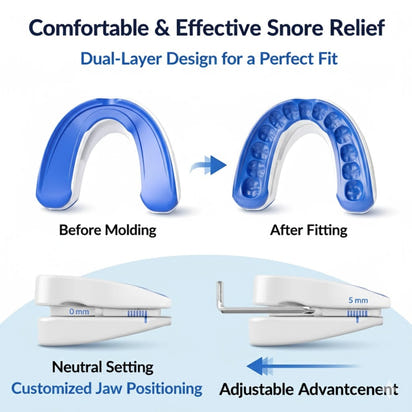 Nooze Anti - Snore Pro™ - Nooze